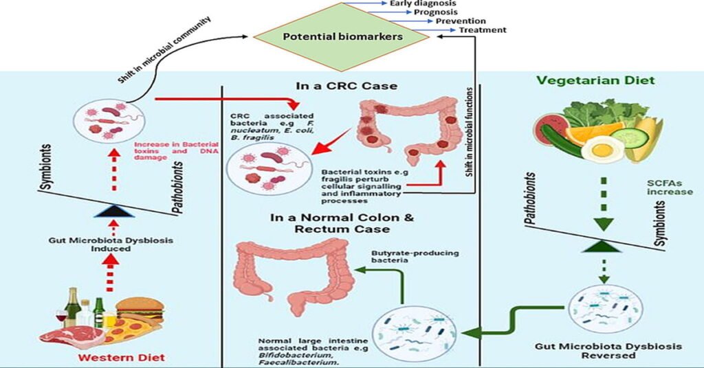 How Gut Microbes Transform Digestion: The Role of Your Microbiome in Wellness